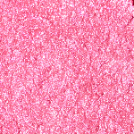 HL01 - Fever Garnet